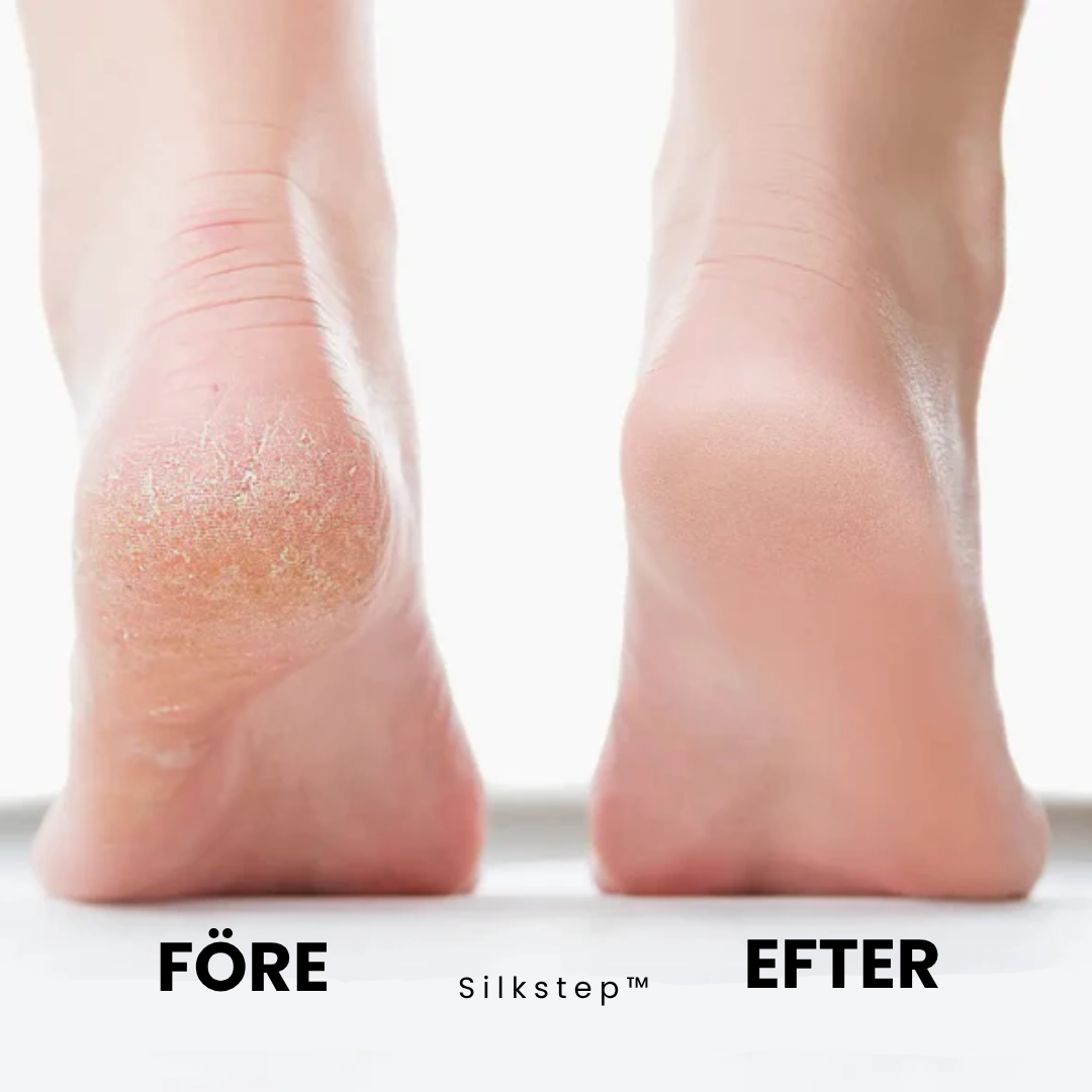 Silkstep™ - Mjuka fötter utan dyra salongsbesök