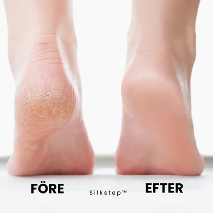 Silkstep™ - Mjuka fötter utan dyra salongsbesök